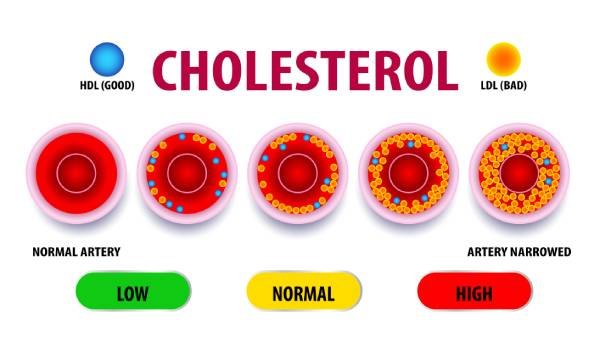 How Do I Reduce My Cholesterol